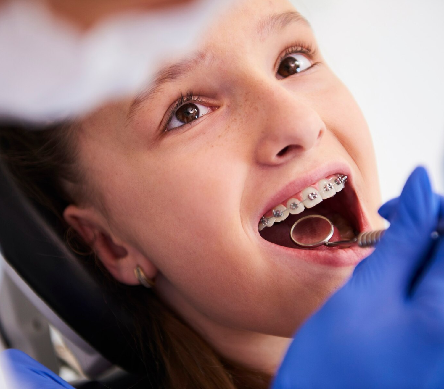 Girl with braces receiving a dental check-up for teeth straightening treatment.