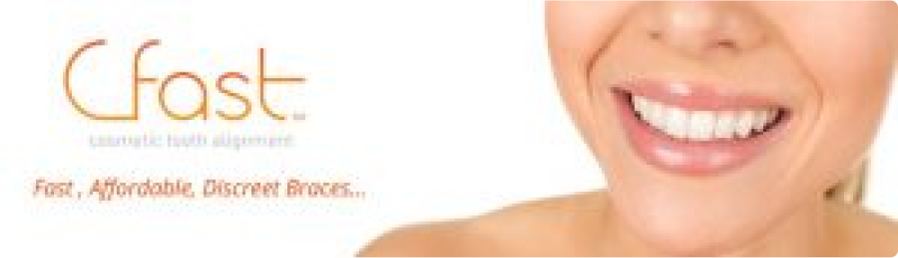 Woman wearing Cfast clear aligners for teeth straightening as part of orthodontic treatment.