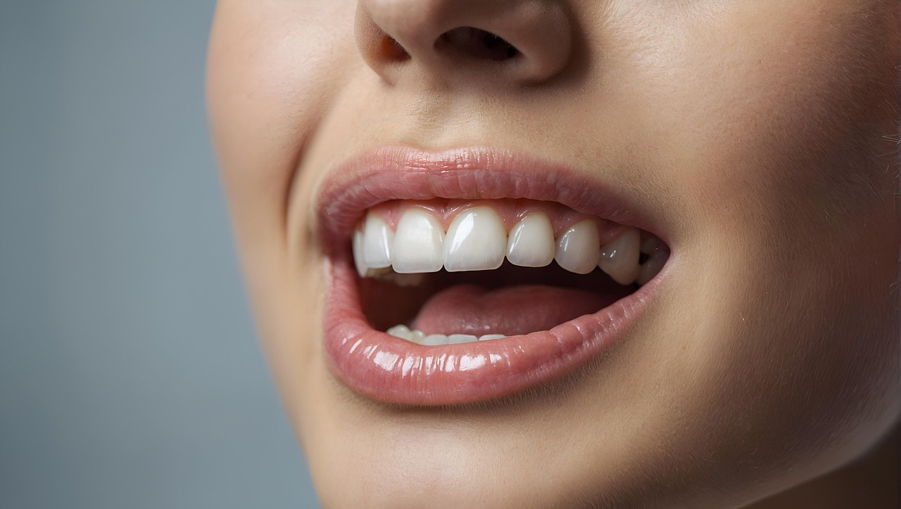 Adelaide wisdom tooth removal, wisdom teeth extraction and tooth removal by dentists Teeth and molars shown in a close-up for wisdom teeth removal Adelaide and wisdom tooth extraction Adelaide.